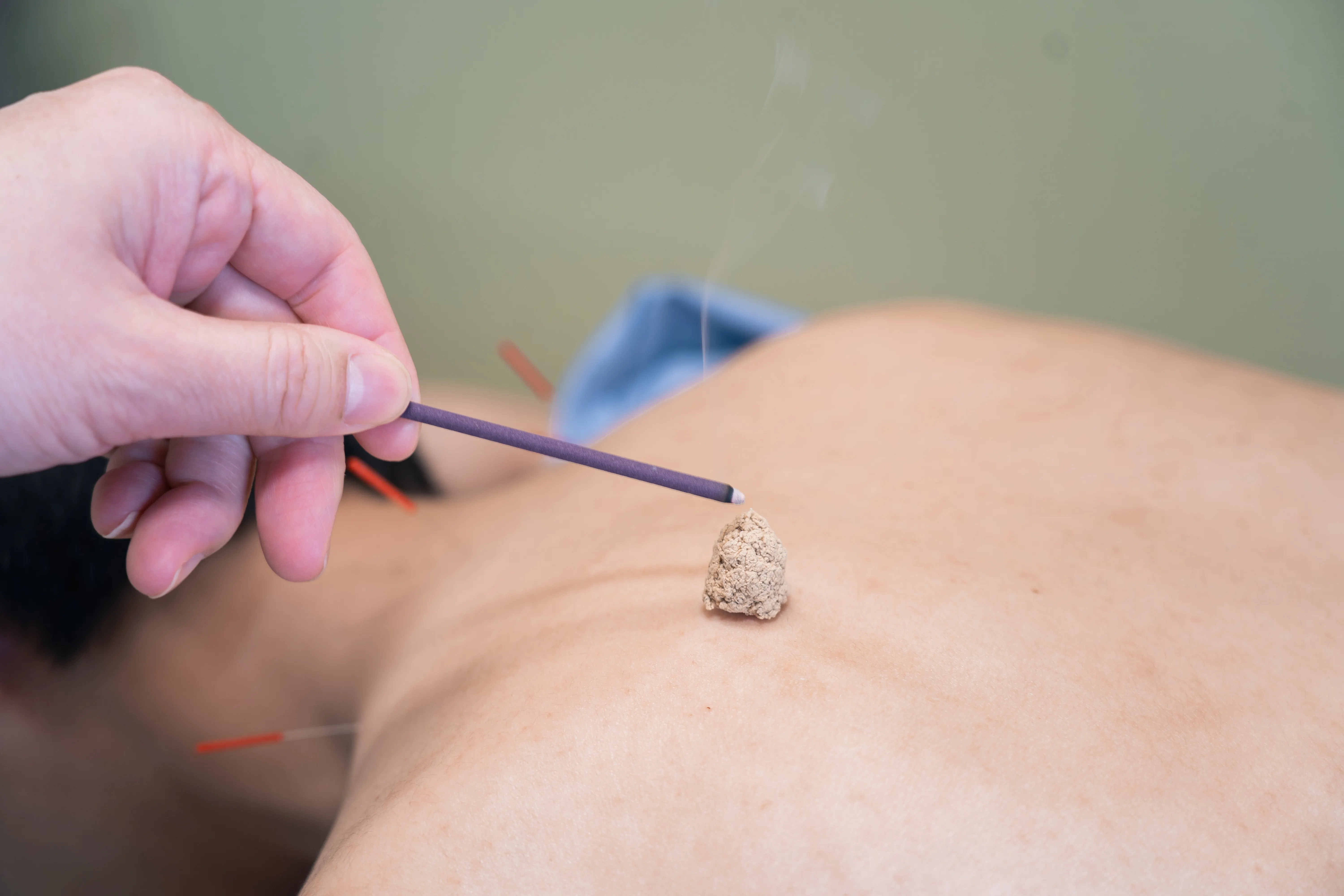 診療コース画像